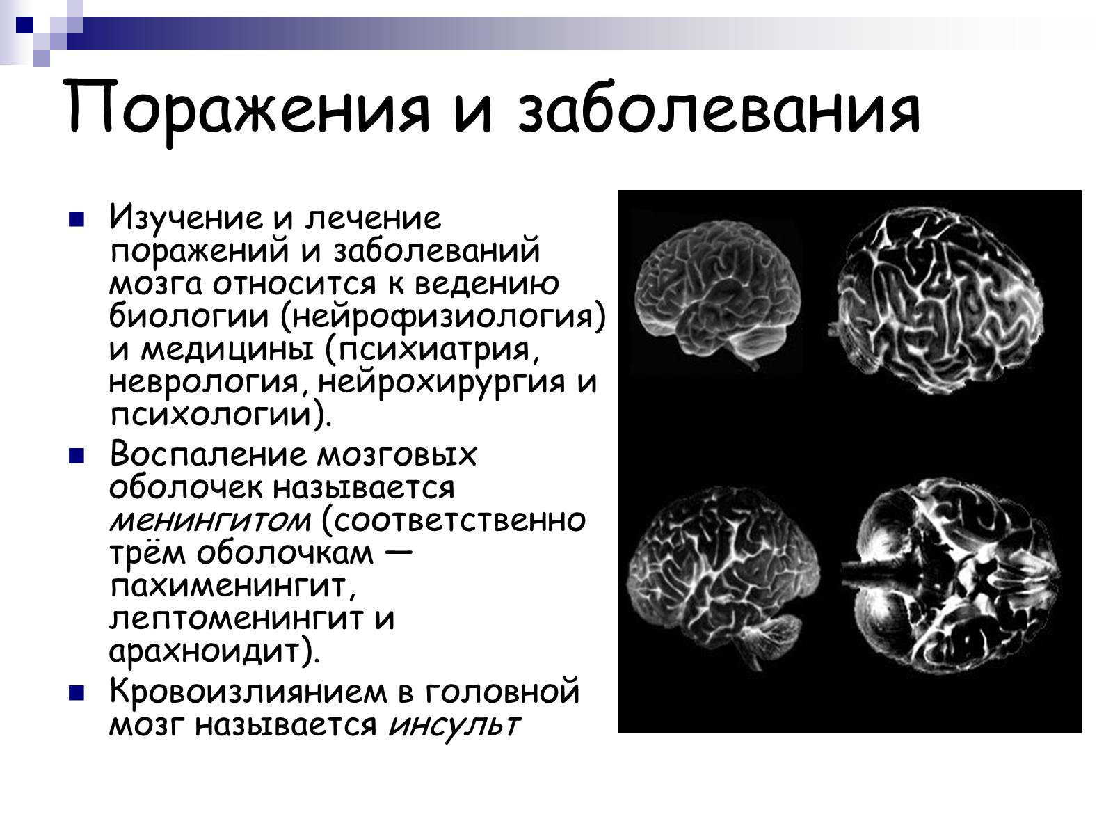 Презентація на тему «Человеский мозг» - Слайд #15 Презентація на тему «Человеский мозг» - Слайд #15
