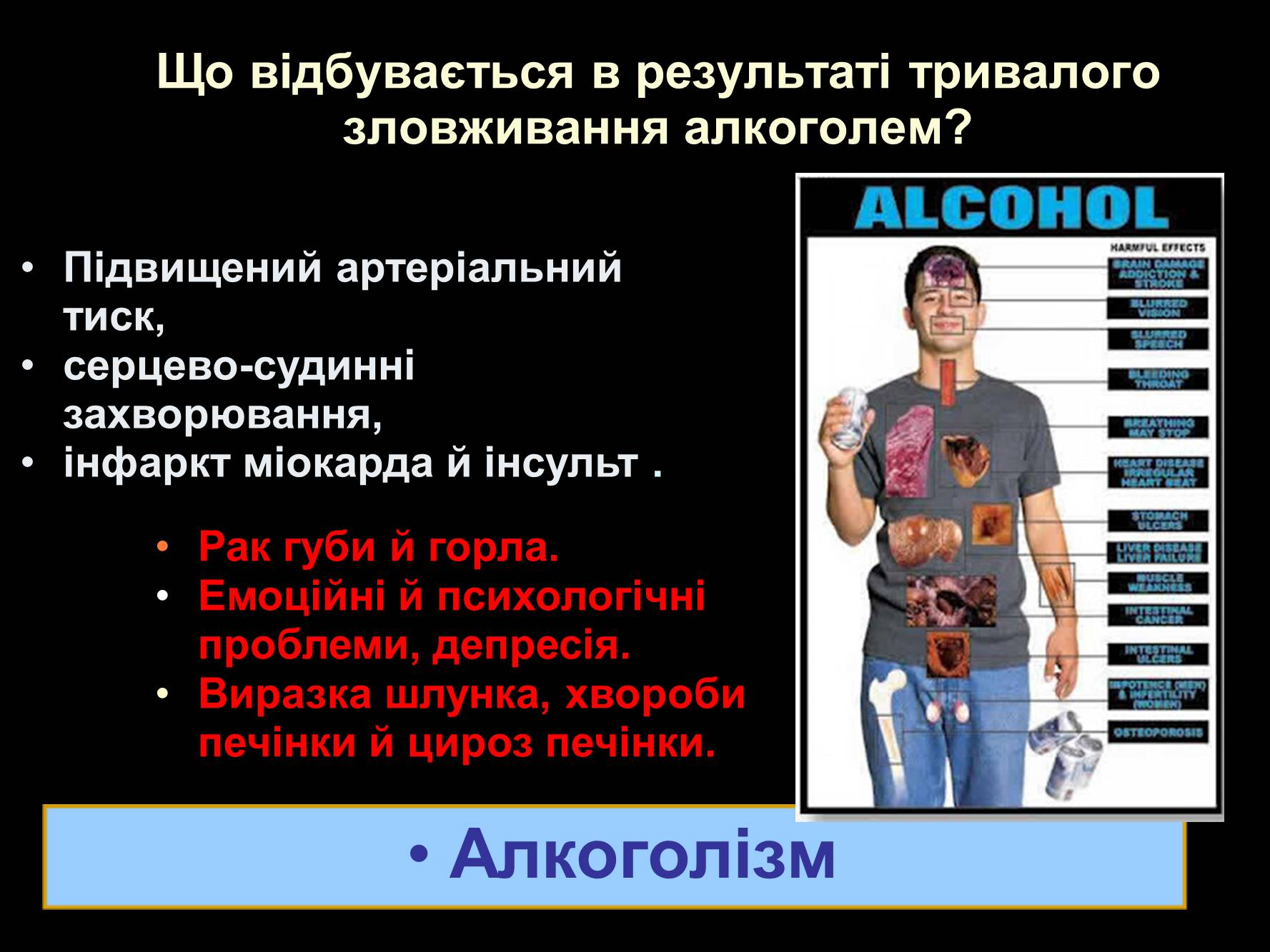 Презентація на тему «Алкоголь» (варіант 2) - Слайд #14 Презентація на тему «Алкоголь» (варіант 2) - Слайд #14