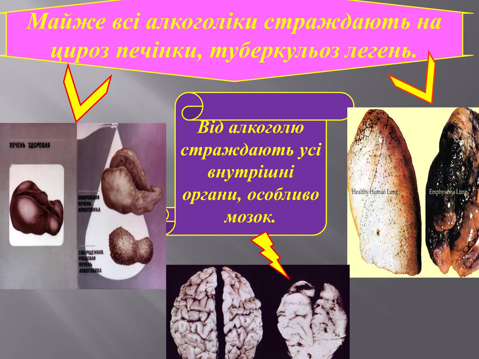 Презентація на тему «Вплив куріння, алкоголю та наркотиків на здоров’я» - Слайд #12 Презентація на тему «Вплив куріння, алкоголю та наркотиків на здоров’я» - Слайд #12