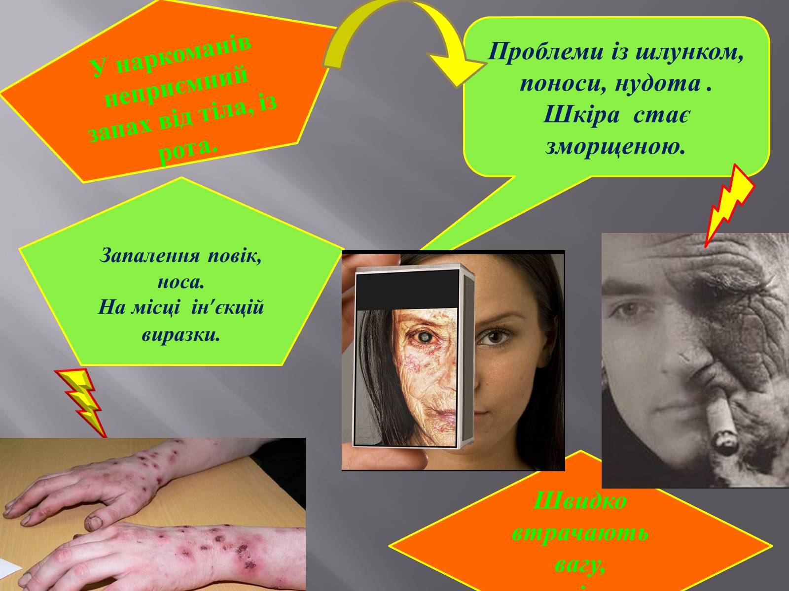Презентація на тему «Вплив куріння, алкоголю та наркотиків на здоров’я» - Слайд #20 Презентація на тему «Вплив куріння, алкоголю та наркотиків на здоров’я» - Слайд #20