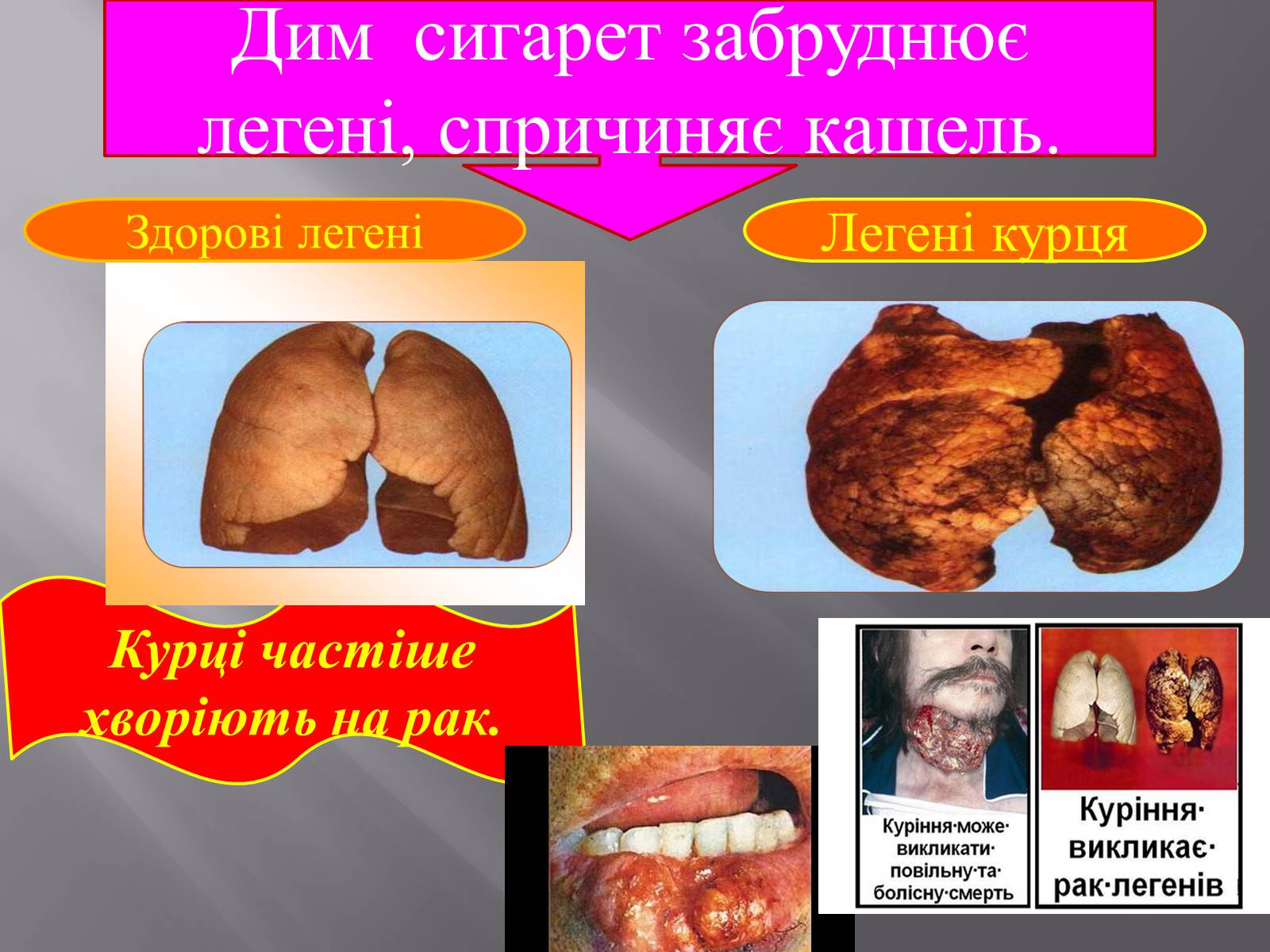 Презентація на тему «Вплив куріння, алкоголю та наркотиків на здоров’я» - Слайд #5 Презентація на тему «Вплив куріння, алкоголю та наркотиків на здоров’я» - Слайд #5