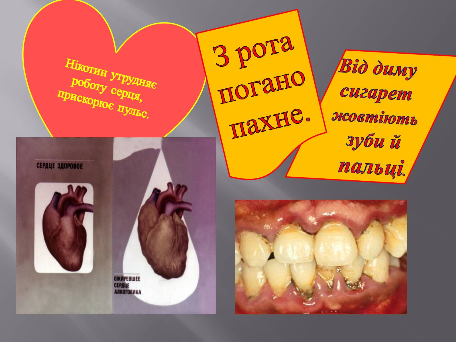 Презентація на тему «Вплив куріння, алкоголю та наркотиків на здоров’я» - Слайд #8 Презентація на тему «Вплив куріння, алкоголю та наркотиків на здоров’я» - Слайд #8