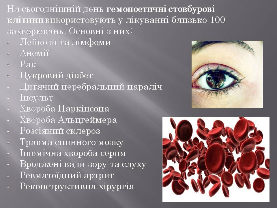 Презентація на тему «Стовбурові клітини» (варіант 6) - Слайд #21 Презентація на тему «Стовбурові клітини» (варіант 6) - Слайд #21