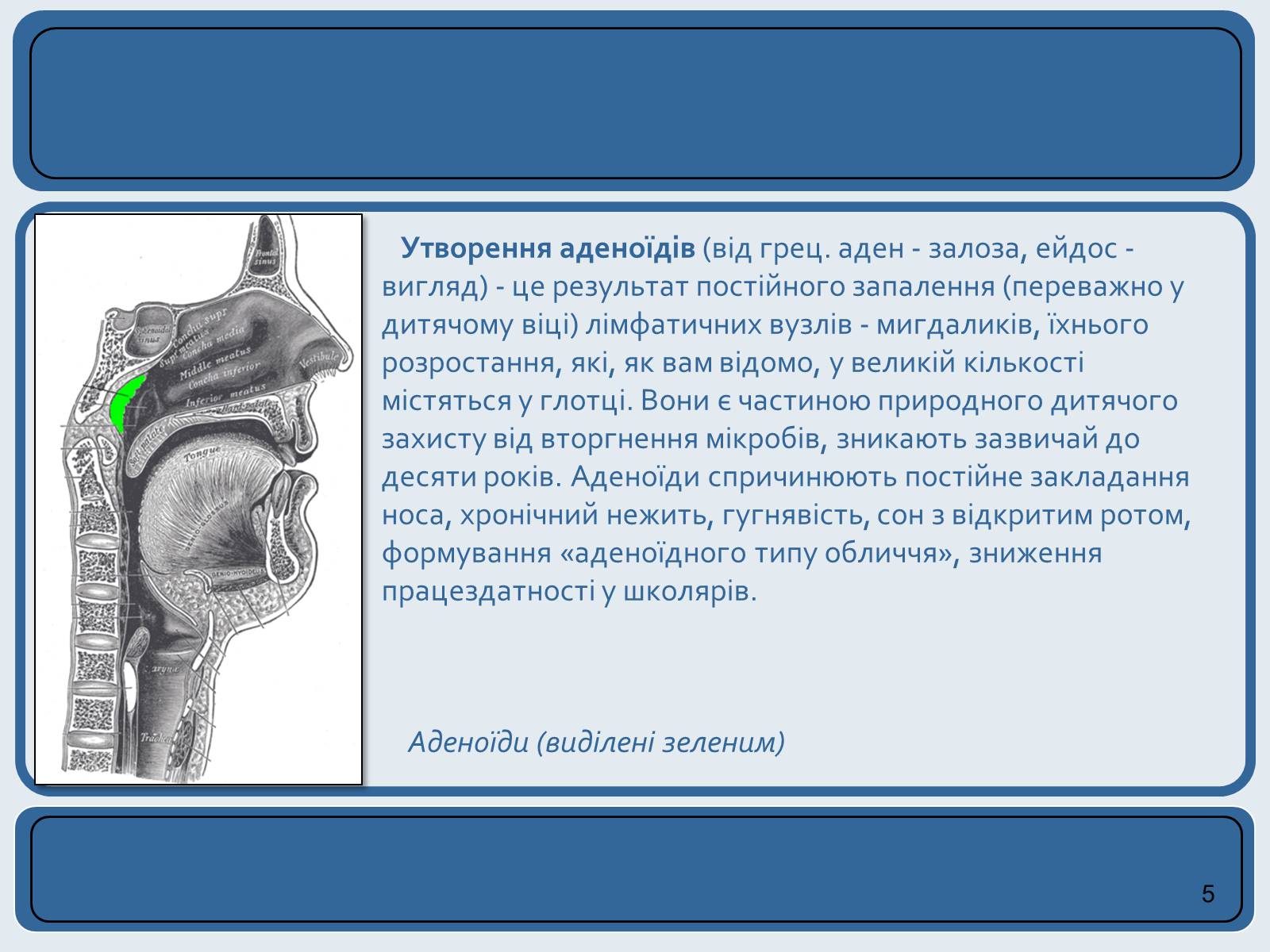 Презентація на тему «Хвороби органів дихання та їх профілактика» (варіант 2) - Слайд #5 Презентація на тему «Хвороби органів дихання та їх профілактика» (варіант 2) - Слайд #5