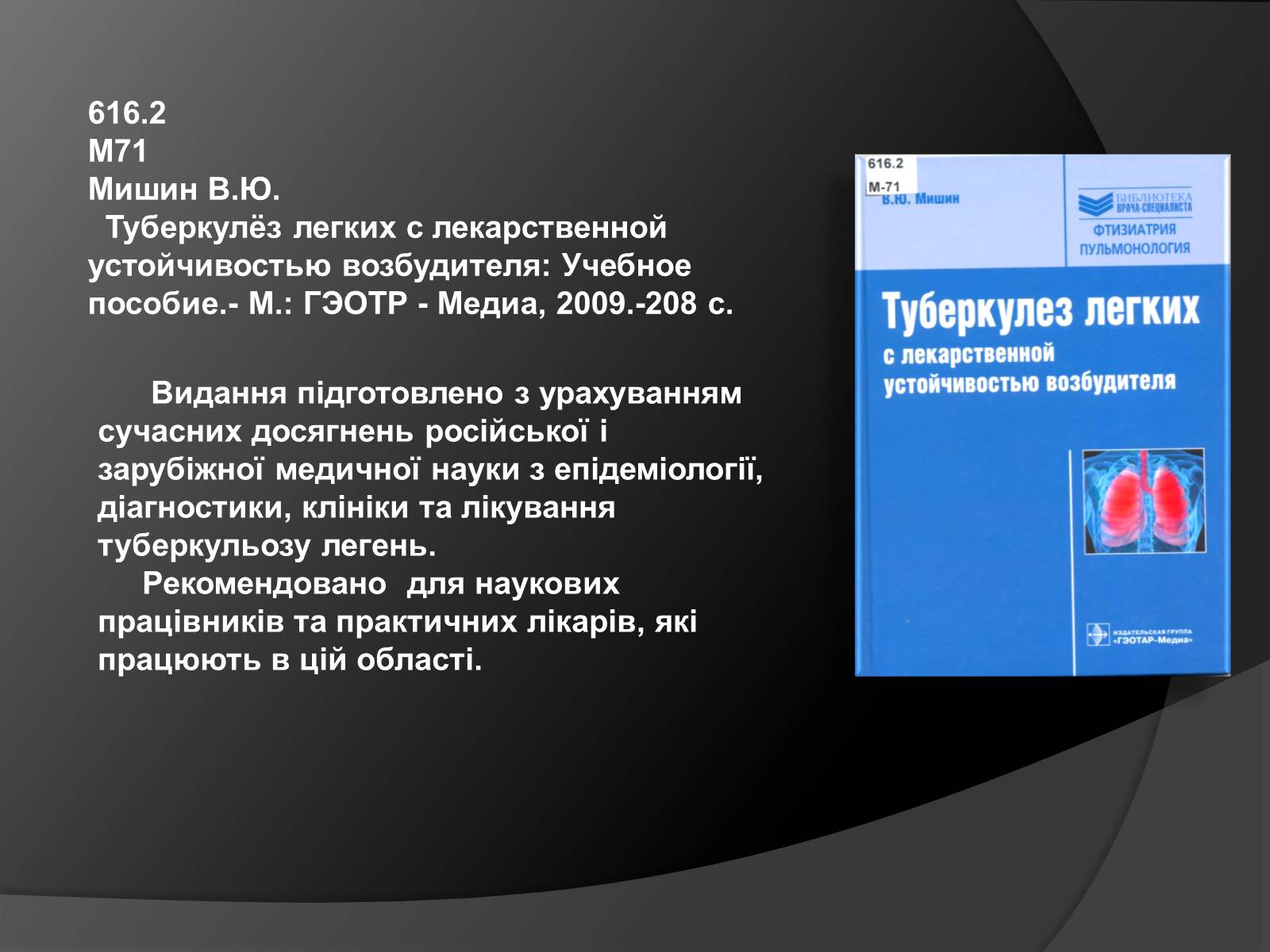 Презентація на тему «Туберкульоз. Сучасні методи діагностики та лікування» - Слайд #11 Презентація на тему «Туберкульоз. Сучасні методи діагностики та лікування» - Слайд #11