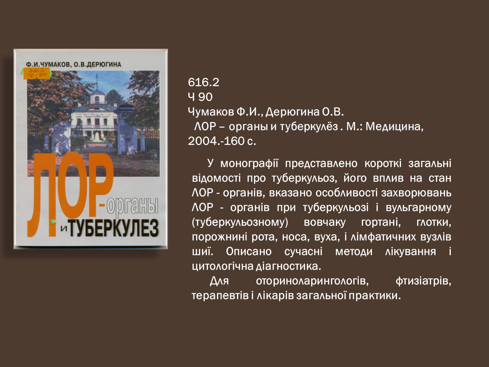 Презентація на тему «Туберкульоз. Сучасні методи діагностики та лікування» - Слайд #12 Презентація на тему «Туберкульоз. Сучасні методи діагностики та лікування» - Слайд #12