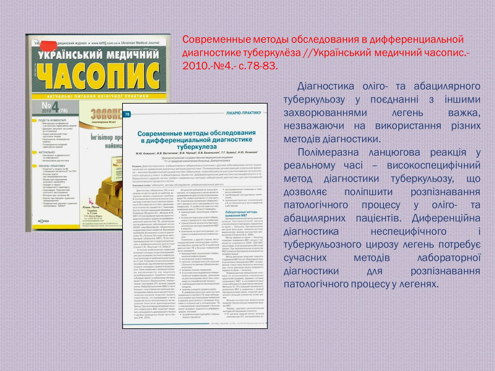 Презентація на тему «Туберкульоз. Сучасні методи діагностики та лікування» - Слайд #13 Презентація на тему «Туберкульоз. Сучасні методи діагностики та лікування» - Слайд #13