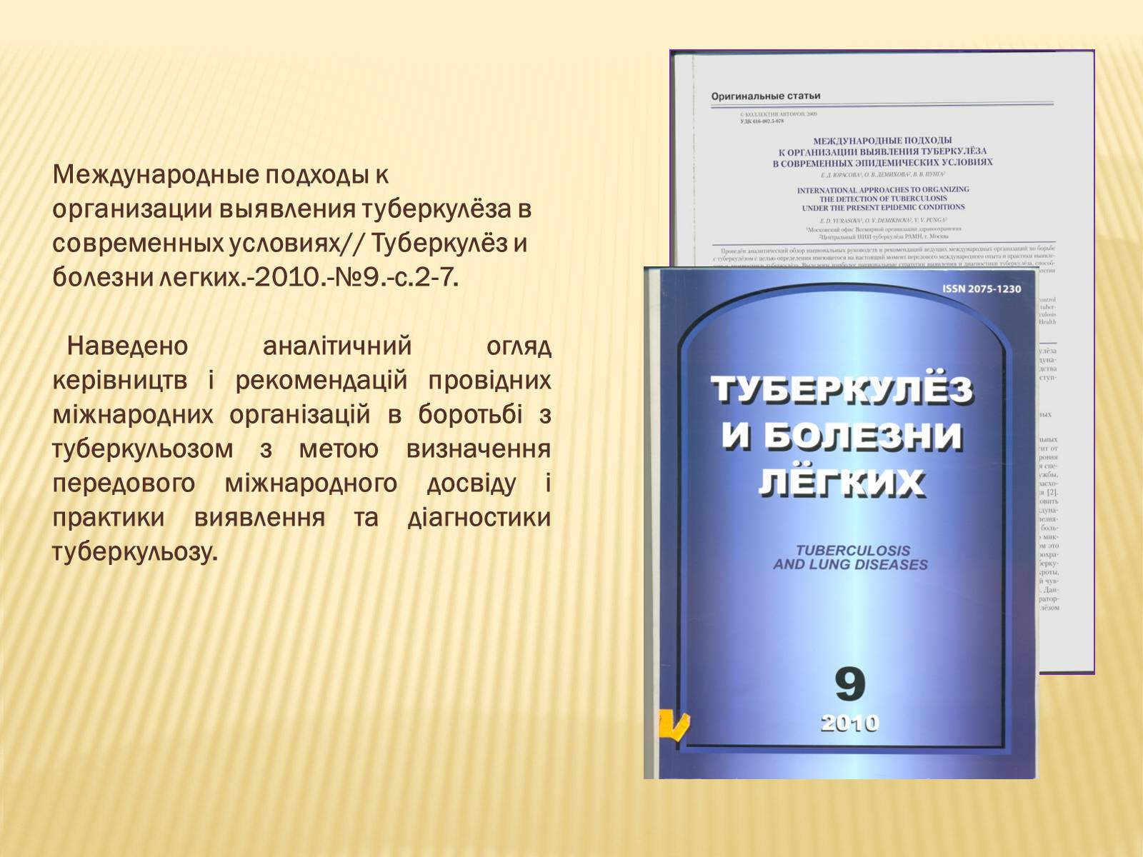 Презентація на тему «Туберкульоз. Сучасні методи діагностики та лікування» - Слайд #14 Презентація на тему «Туберкульоз. Сучасні методи діагностики та лікування» - Слайд #14
