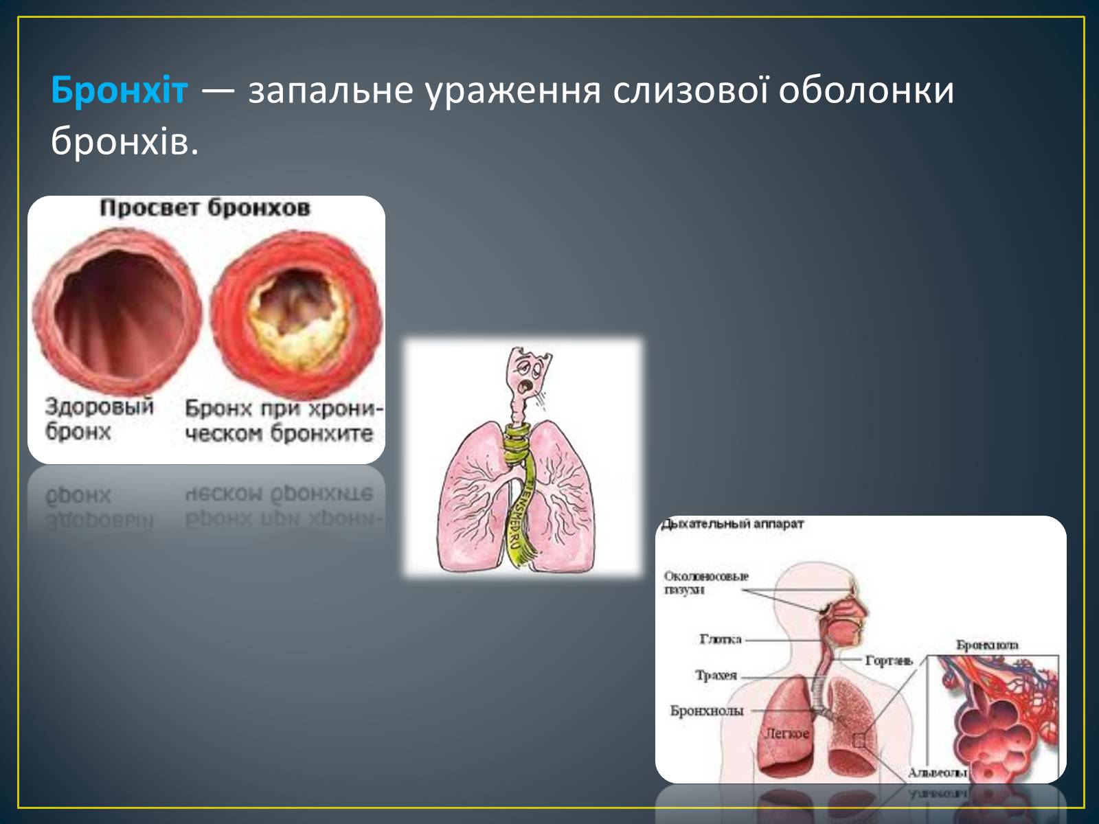 Презентація на тему «Захворювання органів дихання» - Слайд #11 Презентація на тему «Захворювання органів дихання» - Слайд #11