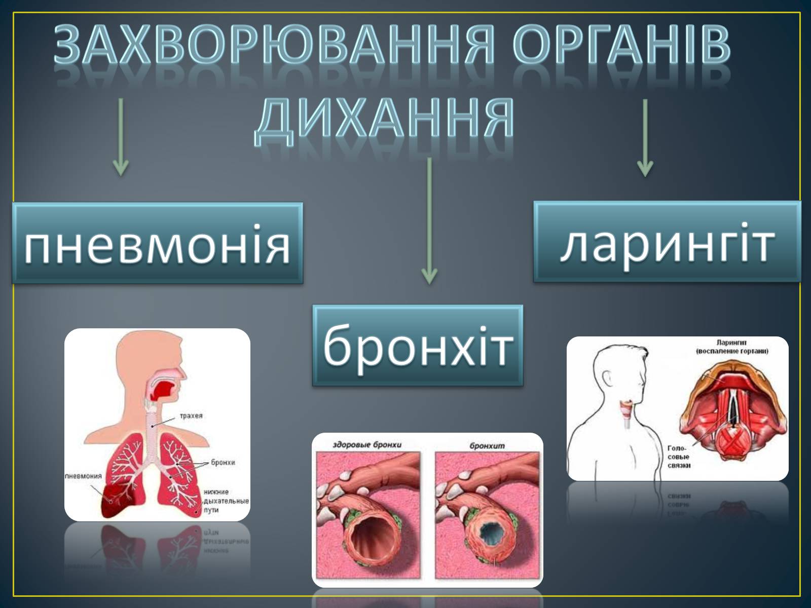 Презентація на тему «Захворювання органів дихання» - Слайд #2 Презентація на тему «Захворювання органів дихання» - Слайд #2