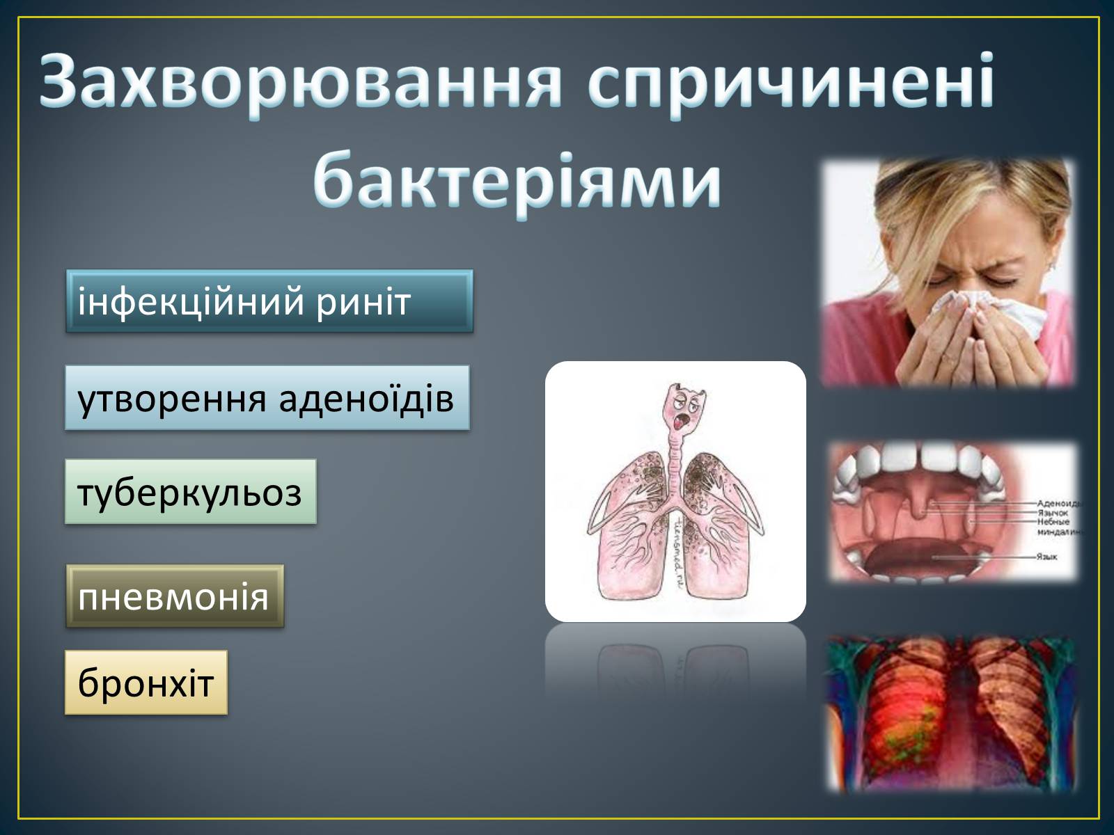 Презентація на тему «Захворювання органів дихання» - Слайд #6 Презентація на тему «Захворювання органів дихання» - Слайд #6
