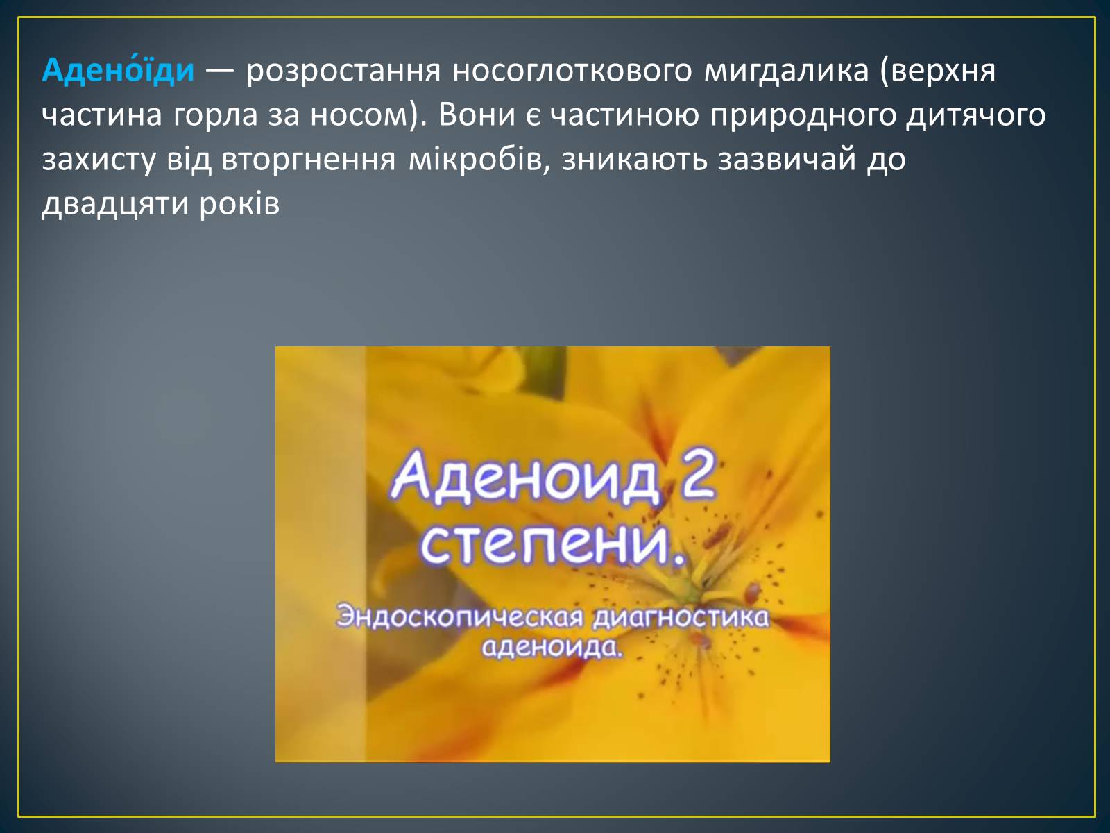 Презентація на тему «Захворювання органів дихання» - Слайд #8 Презентація на тему «Захворювання органів дихання» - Слайд #8