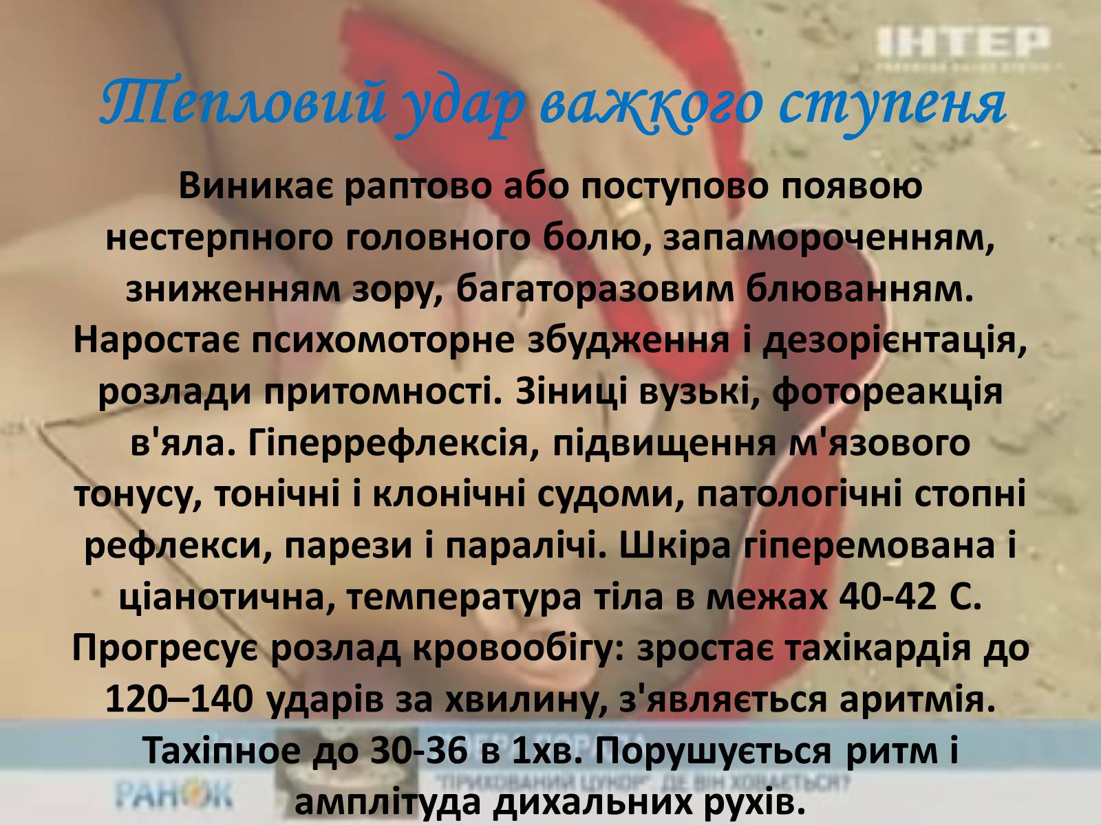 Презентація на тему «Тепловий і сонячний удар» (варіант 2) - Слайд #5 Презентація на тему «Тепловий і сонячний удар» (варіант 2) - Слайд #5