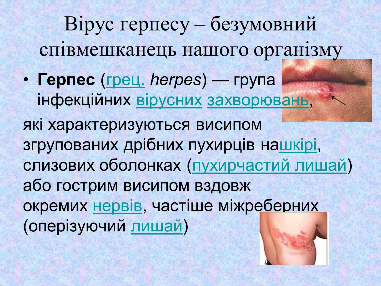 Презентація на тему «Вірус Герпесу» - Слайд #2 Презентація на тему «Вірус Герпесу» - Слайд #2