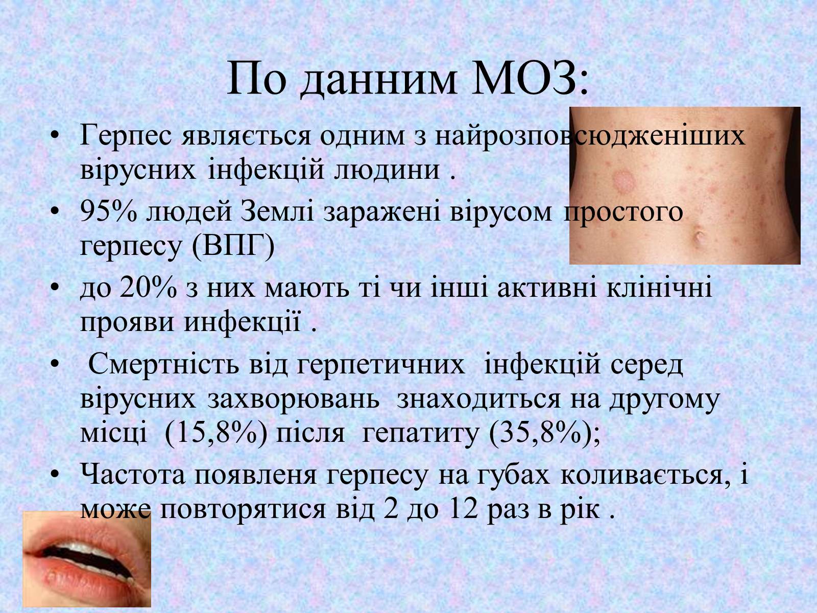 Презентація на тему «Вірус Герпесу» - Слайд #4 Презентація на тему «Вірус Герпесу» - Слайд #4