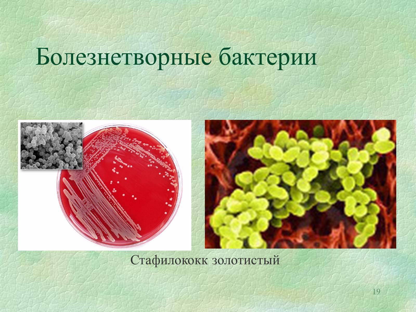 Презентація на тему «Значение бактерий в природе и жизни человека» - Слайд #19 Презентація на тему «Значение бактерий в природе и жизни человека» - Слайд #19