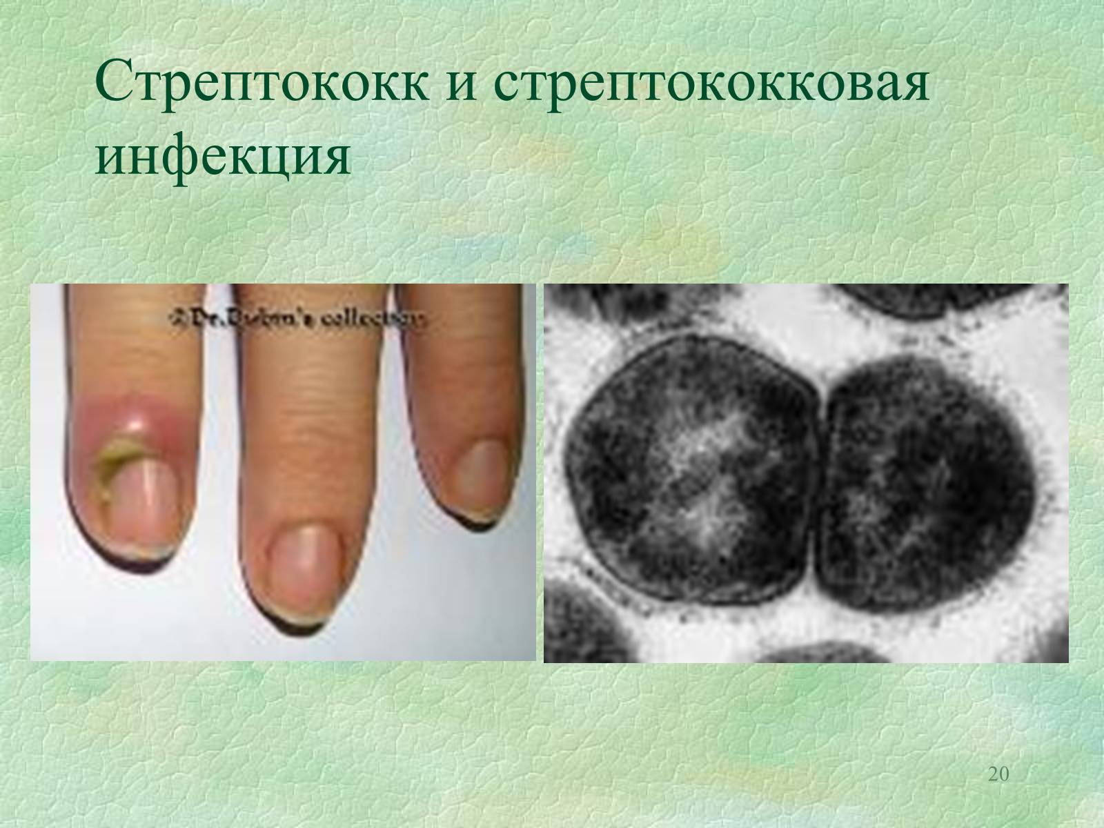 Презентація на тему «Значение бактерий в природе и жизни человека» - Слайд #20 Презентація на тему «Значение бактерий в природе и жизни человека» - Слайд #20