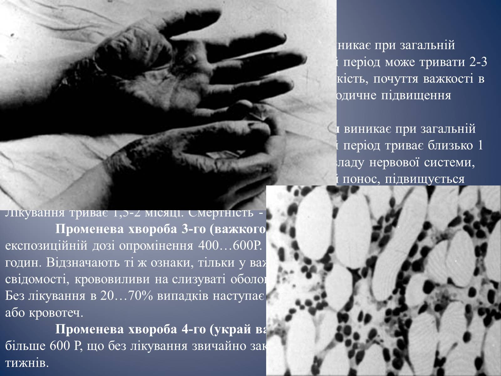 Презентація на тему «Радіаційне ураження» (варіант 1) - Слайд #7 Презентація на тему «Радіаційне ураження» (варіант 1) - Слайд #7