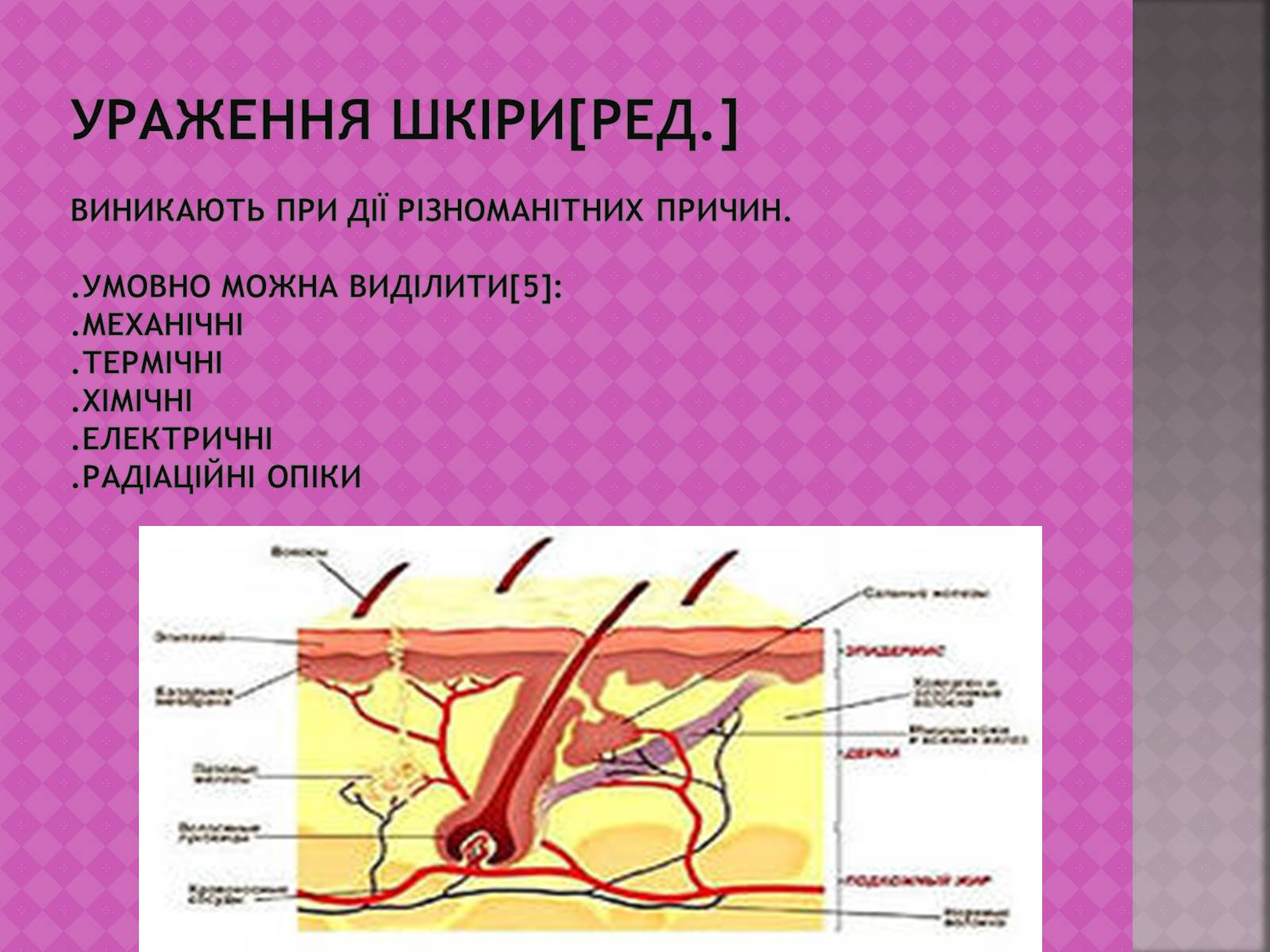 Презентація на тему «Шкіра, та її хвороби» - Слайд #6 Презентація на тему «Шкіра, та її хвороби» - Слайд #6