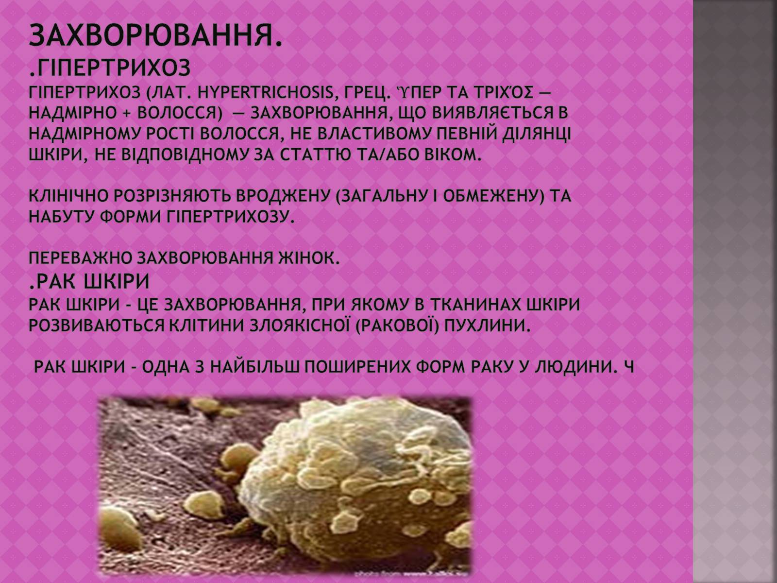 Презентація на тему «Шкіра, та її хвороби» - Слайд #7 Презентація на тему «Шкіра, та її хвороби» - Слайд #7