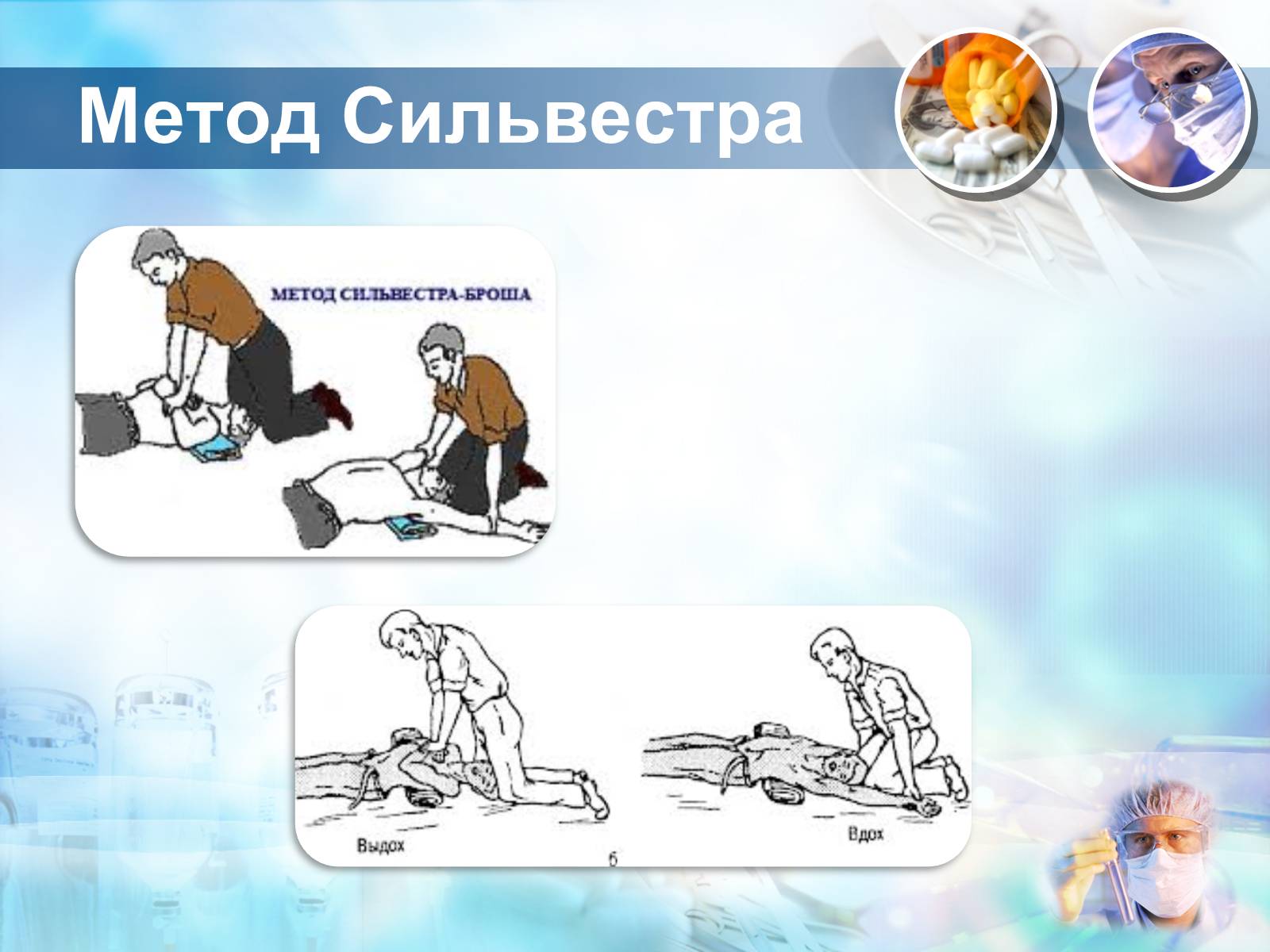 Презентація на тему «Методика проведення штучного дихання і закритого масажу серця» - Слайд #6 Презентація на тему «Методика проведення штучного дихання і закритого масажу серця» - Слайд #6