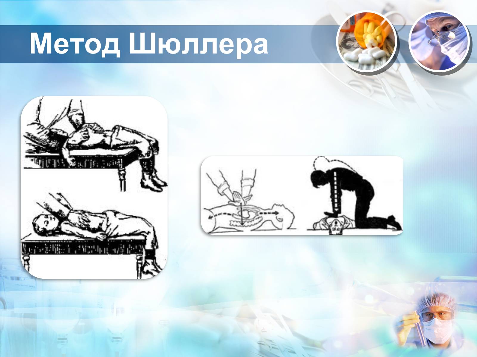 Презентація на тему «Методика проведення штучного дихання і закритого масажу серця» - Слайд #7 Презентація на тему «Методика проведення штучного дихання і закритого масажу серця» - Слайд #7