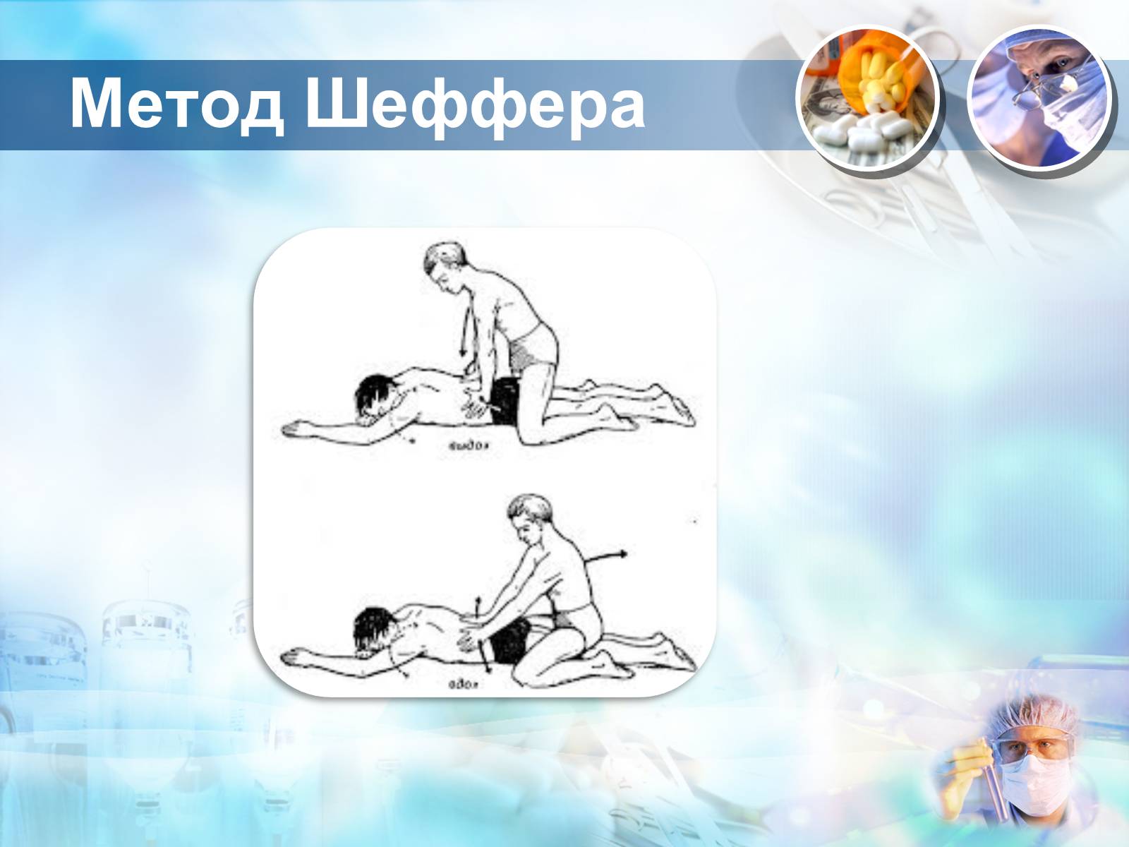 Презентація на тему «Методика проведення штучного дихання і закритого масажу серця» - Слайд #8 Презентація на тему «Методика проведення штучного дихання і закритого масажу серця» - Слайд #8