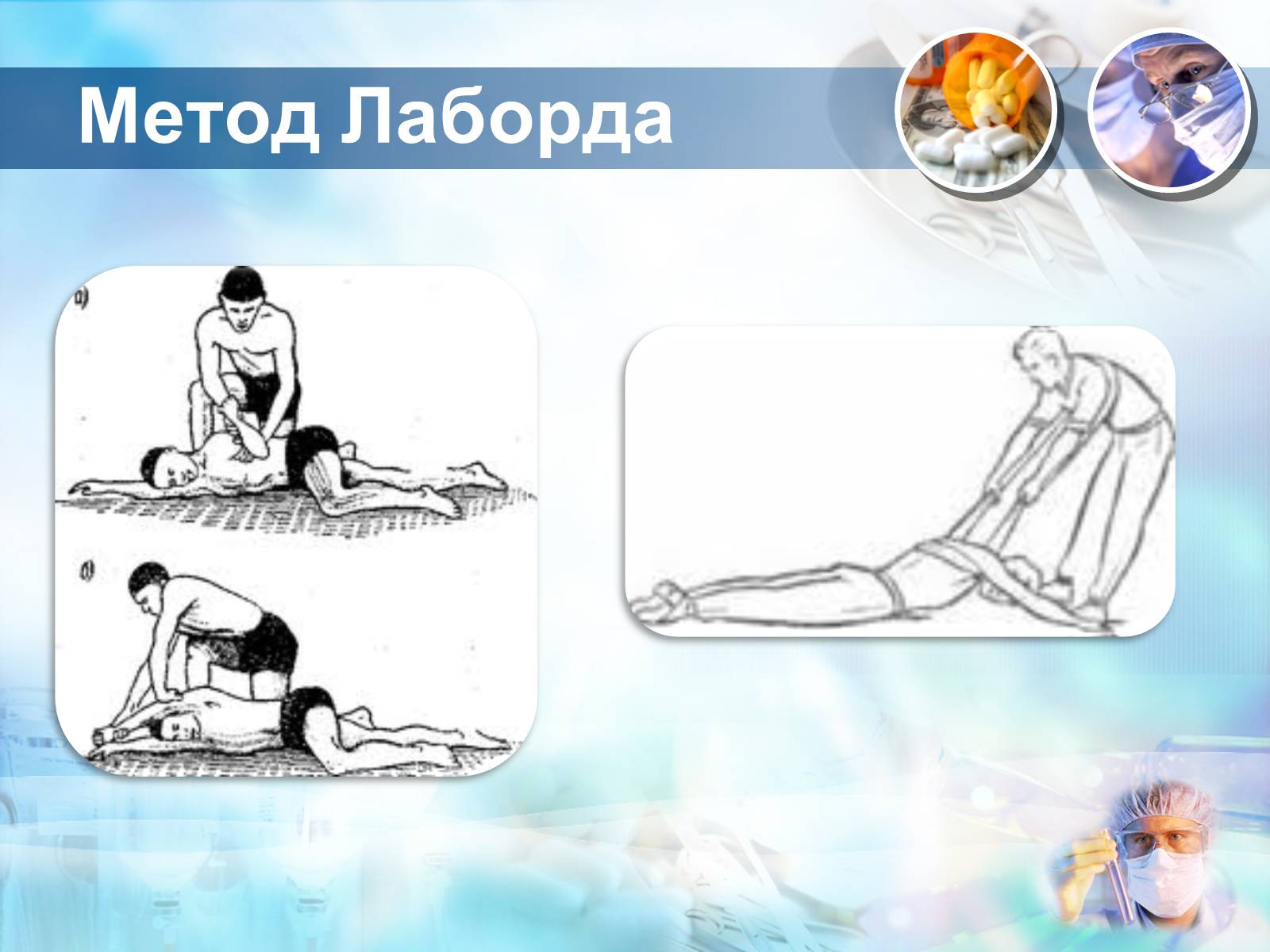 Презентація на тему «Методика проведення штучного дихання і закритого масажу серця» - Слайд #9 Презентація на тему «Методика проведення штучного дихання і закритого масажу серця» - Слайд #9