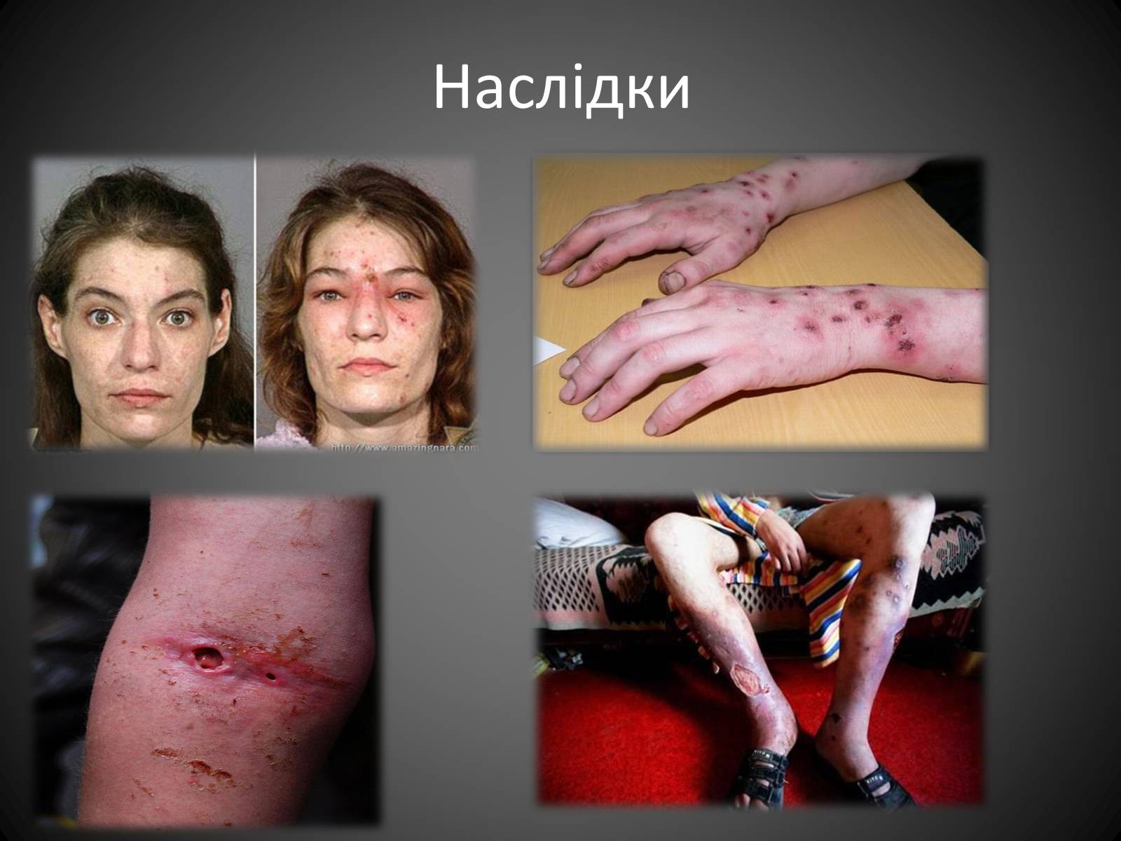 Презентація на тему «Наркоманія» (варіант 4) - Слайд #10 Презентація на тему «Наркоманія» (варіант 4) - Слайд #10