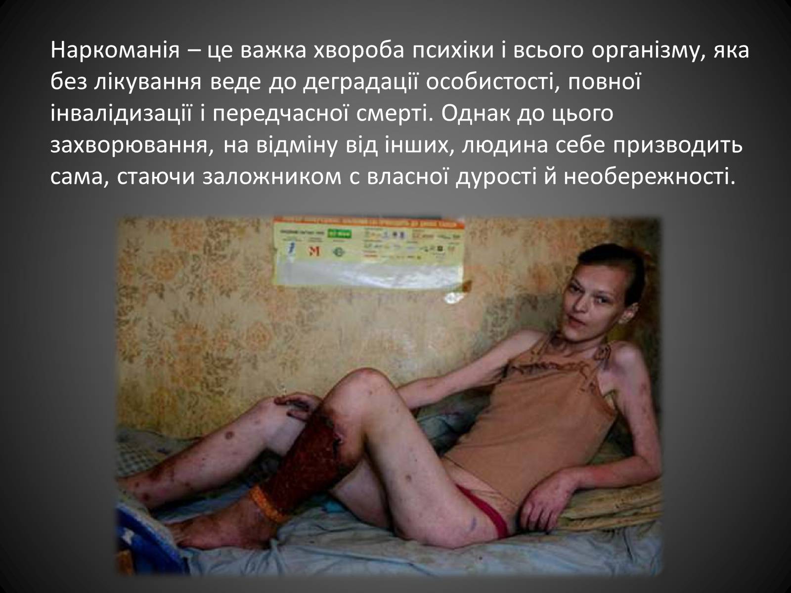 Презентація на тему «Наркоманія» (варіант 4) - Слайд #2 Презентація на тему «Наркоманія» (варіант 4) - Слайд #2