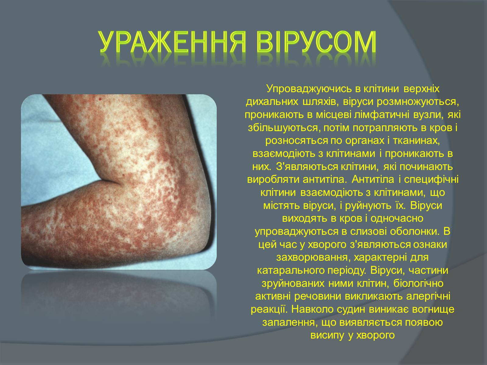 Презентація на тему «Вірусні захворювання» (варіант 2) - Слайд #7 Презентація на тему «Вірусні захворювання» (варіант 2) - Слайд #7