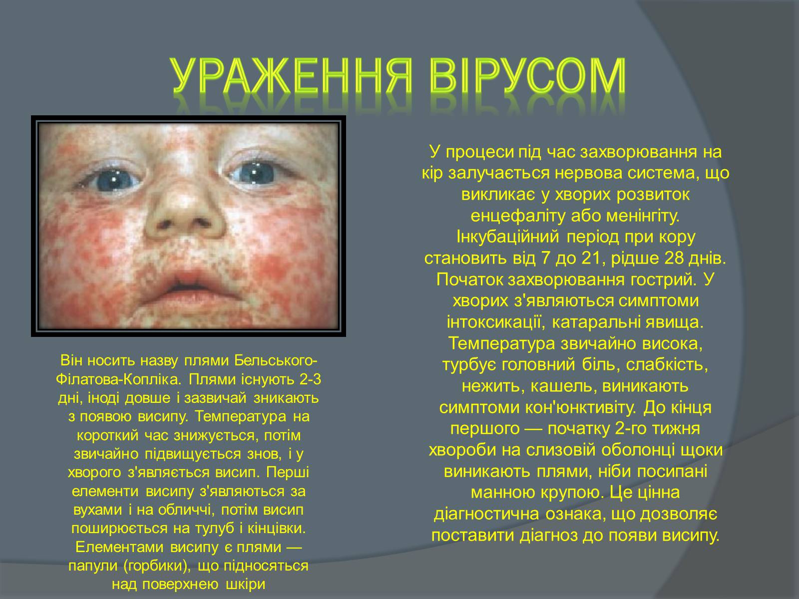 Презентація на тему «Вірусні захворювання» (варіант 2) - Слайд #8 Презентація на тему «Вірусні захворювання» (варіант 2) - Слайд #8
