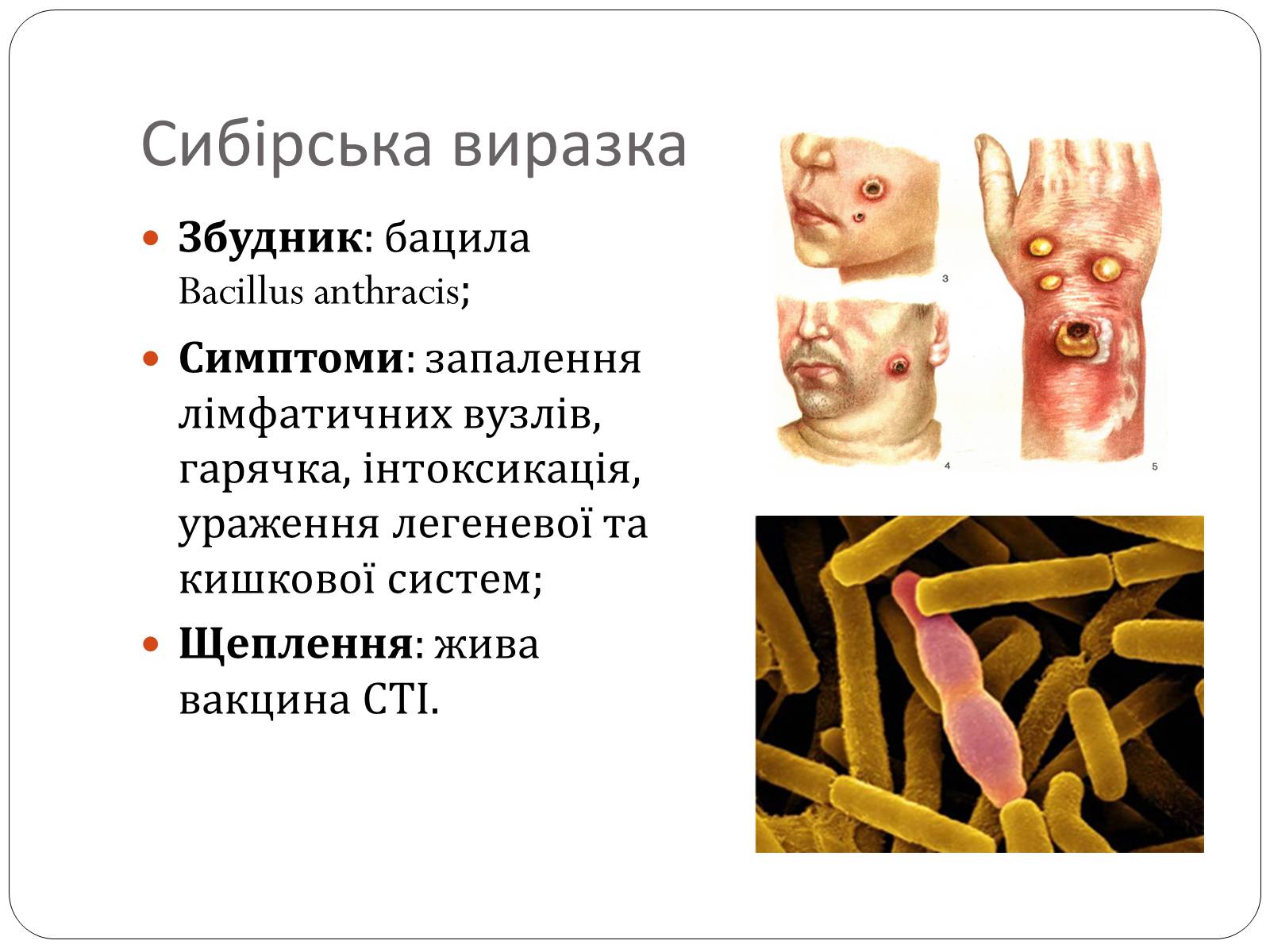 Презентація на тему «Інфекційні захворювання» (варіант 3) - Слайд #11 Презентація на тему «Інфекційні захворювання» (варіант 3) - Слайд #11