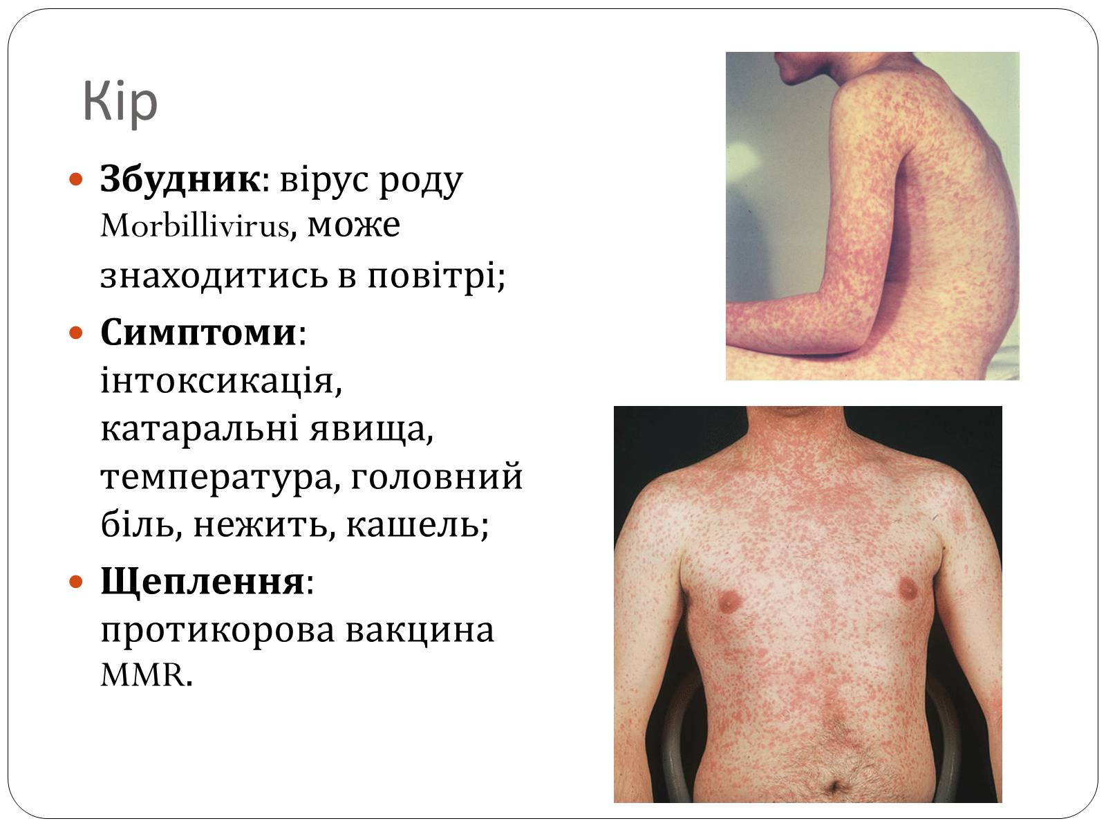 Презентація на тему «Інфекційні захворювання» (варіант 3) - Слайд #2 Презентація на тему «Інфекційні захворювання» (варіант 3) - Слайд #2