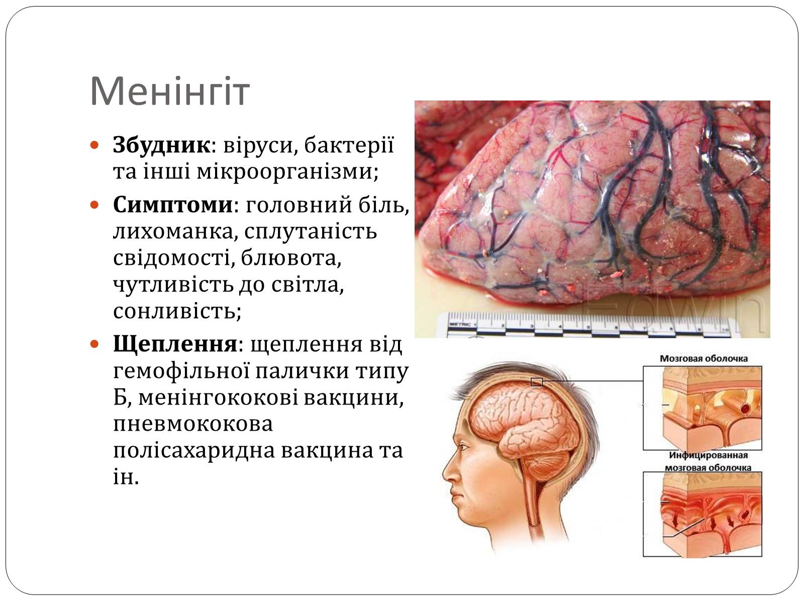 Презентація на тему «Інфекційні захворювання» (варіант 3) - Слайд #6 Презентація на тему «Інфекційні захворювання» (варіант 3) - Слайд #6