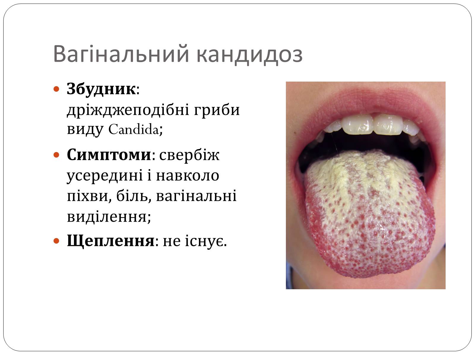 Презентація на тему «Інфекційні захворювання» (варіант 3) - Слайд #8 Презентація на тему «Інфекційні захворювання» (варіант 3) - Слайд #8