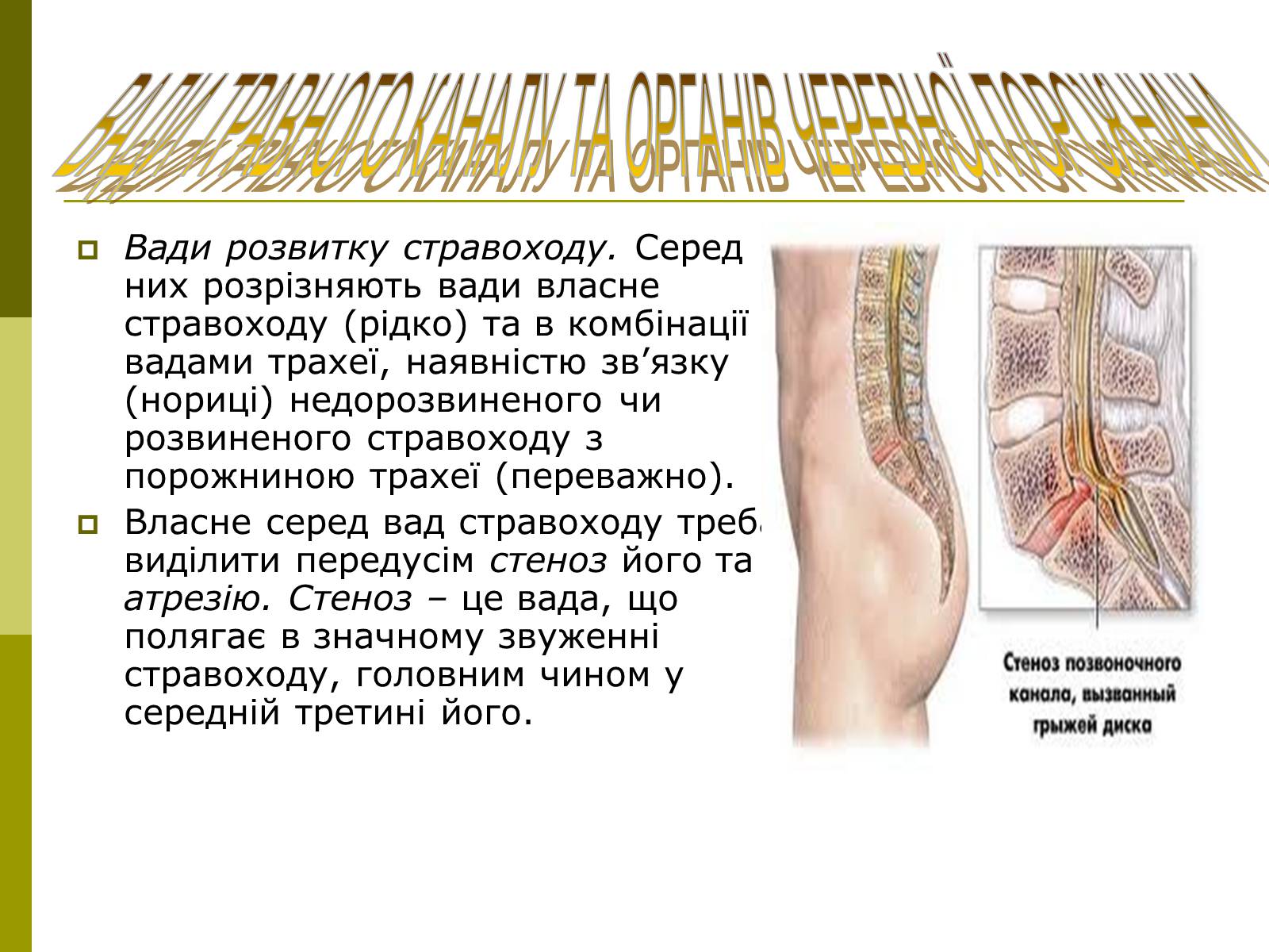 Презентація на тему «Вади розвитку організмів» (варіант 1) - Слайд #13 Презентація на тему «Вади розвитку організмів» (варіант 1) - Слайд #13
