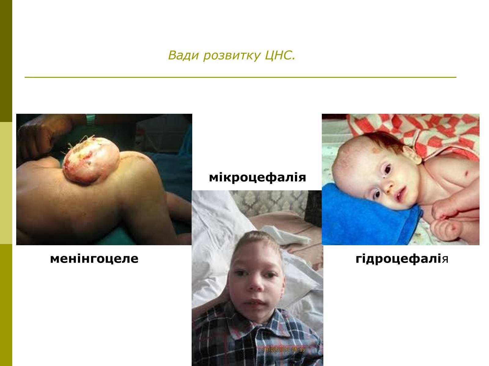 Презентація на тему «Вади розвитку організмів» (варіант 1) - Слайд #8 Презентація на тему «Вади розвитку організмів» (варіант 1) - Слайд #8