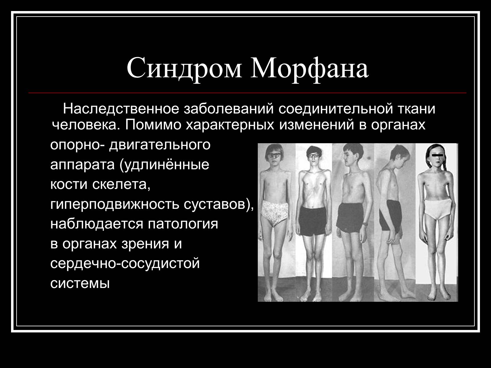Презентація на тему «Генетика человека» (варіант 1) - Слайд #11 Презентація на тему «Генетика человека» (варіант 1) - Слайд #11