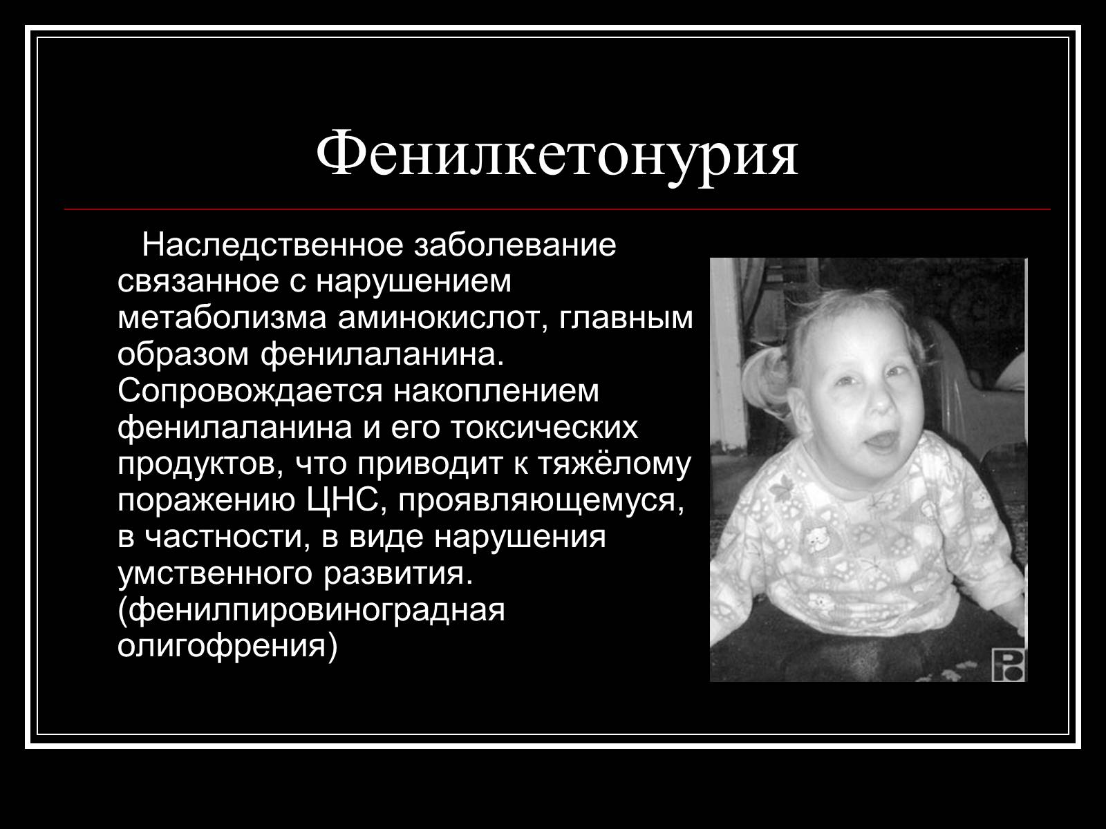 Презентація на тему «Генетика человека» (варіант 1) - Слайд #12 Презентація на тему «Генетика человека» (варіант 1) - Слайд #12