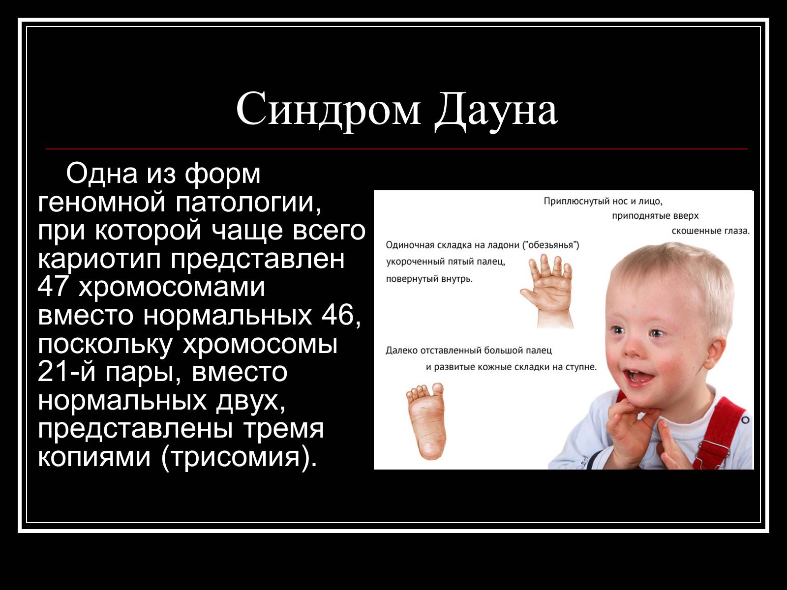Презентація на тему «Генетика человека» (варіант 1) - Слайд #15 Презентація на тему «Генетика человека» (варіант 1) - Слайд #15