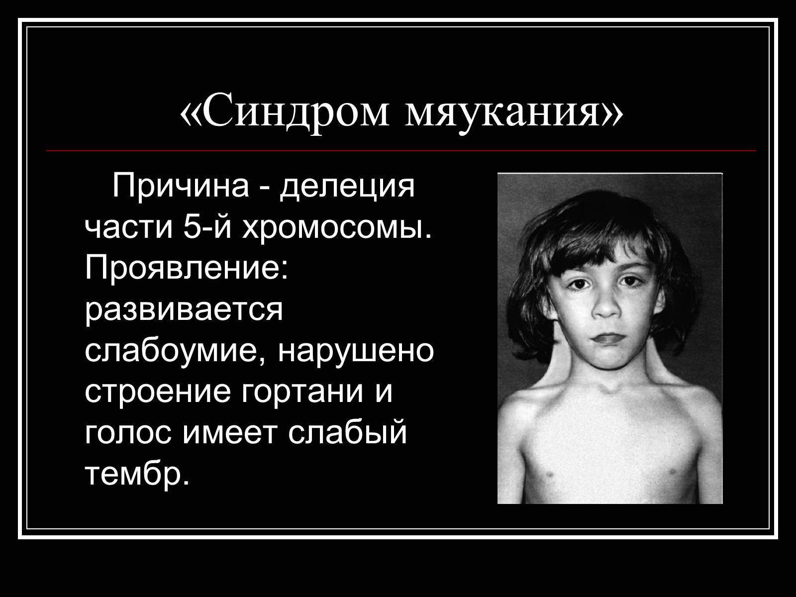 Презентація на тему «Генетика человека» (варіант 1) - Слайд #17 Презентація на тему «Генетика человека» (варіант 1) - Слайд #17
