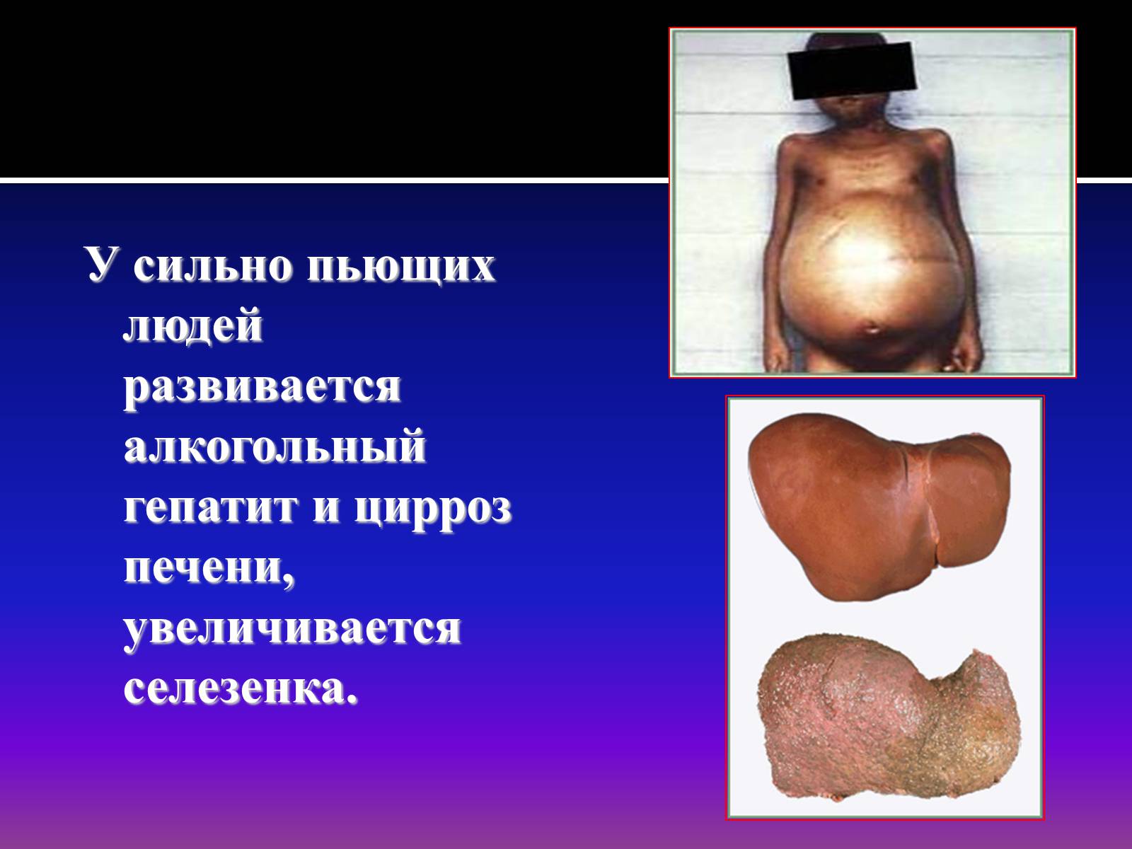 Презентація на тему «Курение» - Слайд #26 Презентація на тему «Курение» - Слайд #26