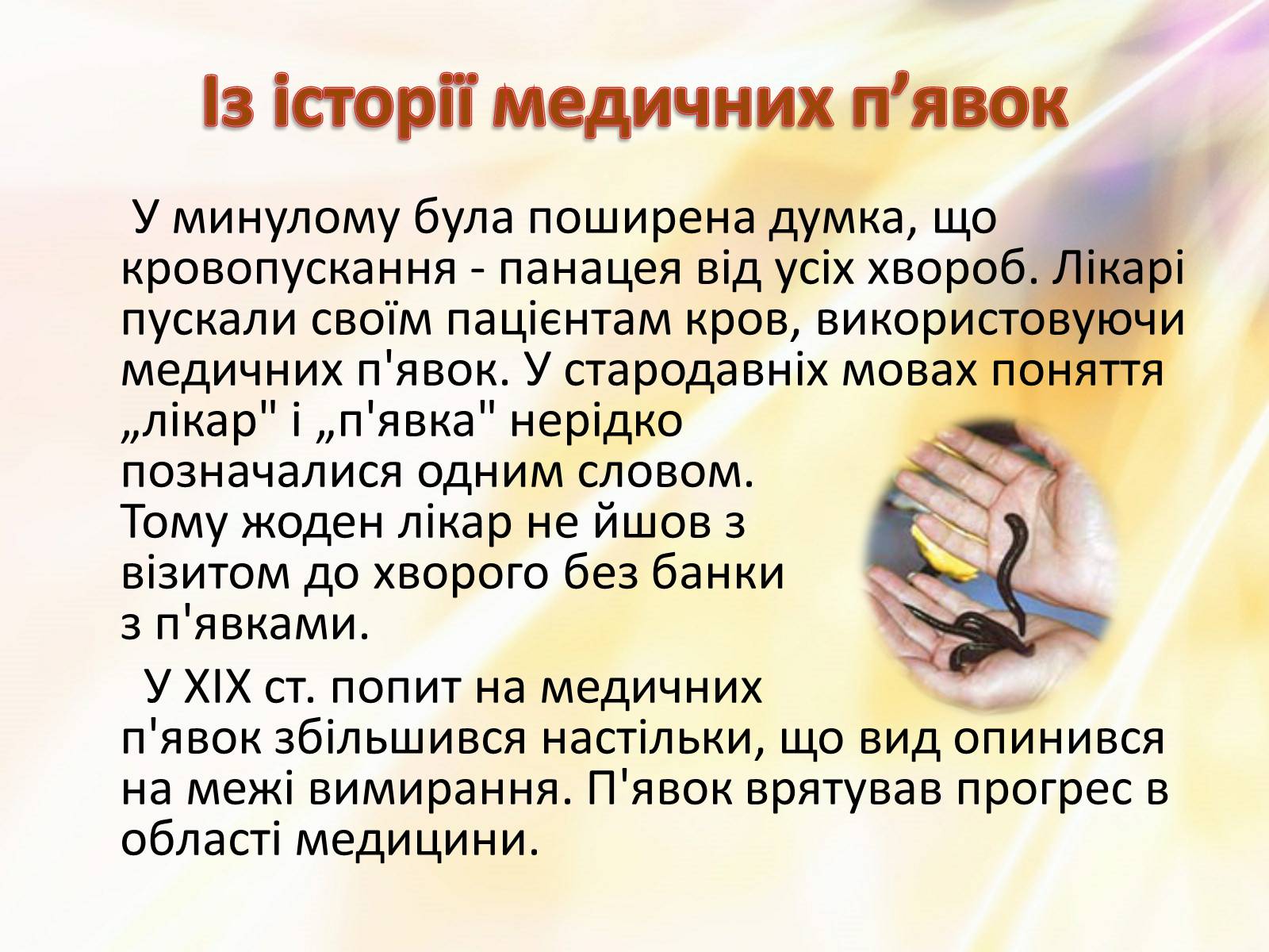 Презентація на тему «П’явки» - Слайд #14 Презентація на тему «П’явки» - Слайд #14