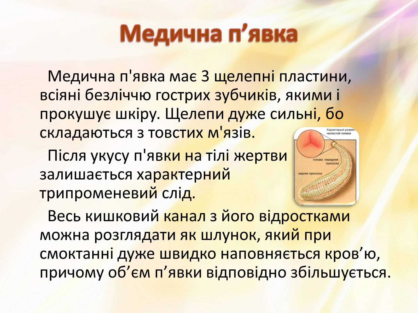 Презентація на тему «П’явки» - Слайд #16 Презентація на тему «П’явки» - Слайд #16
