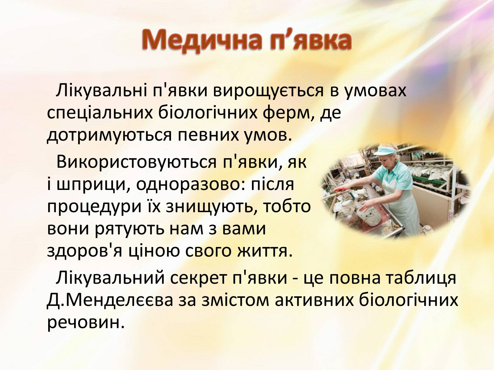Презентація на тему «П’явки» - Слайд #17 Презентація на тему «П’явки» - Слайд #17