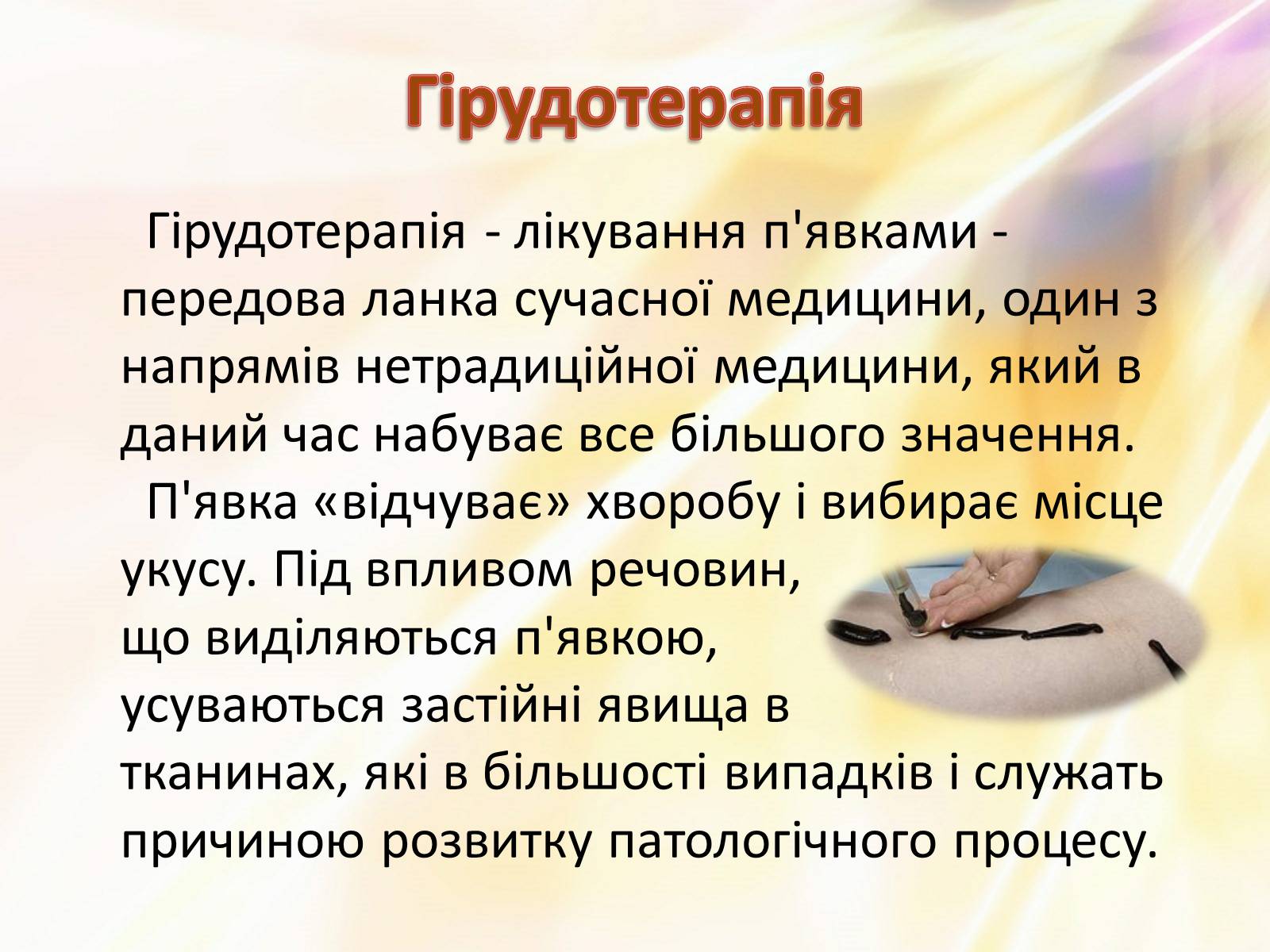 Презентація на тему «П’явки» - Слайд #19 Презентація на тему «П’явки» - Слайд #19