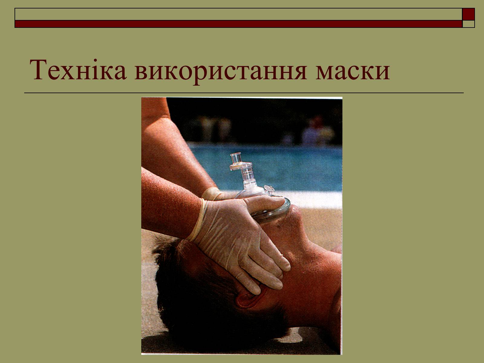 Презентація на тему «Перша медична допомога» (варіант 2) - Слайд #22 Презентація на тему «Перша медична допомога» (варіант 2) - Слайд #22
