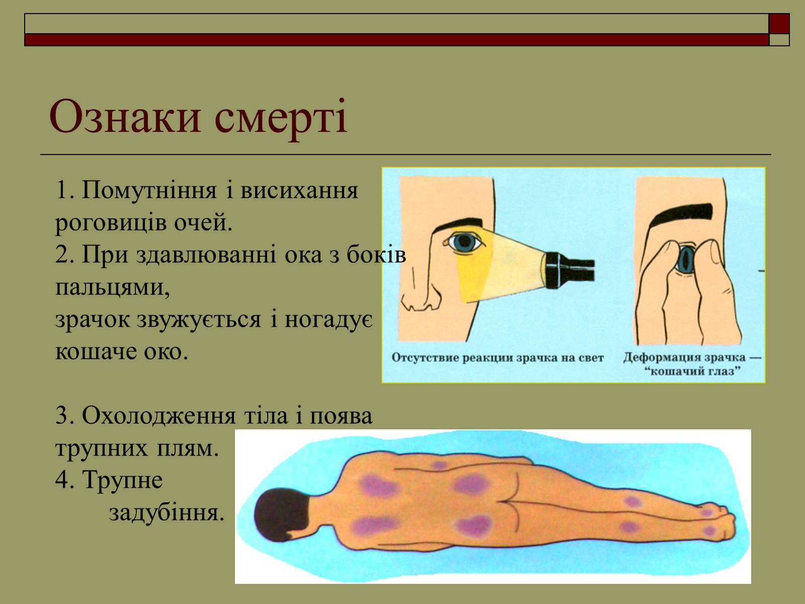 Презентація на тему «Перша медична допомога» (варіант 2) - Слайд #6 Презентація на тему «Перша медична допомога» (варіант 2) - Слайд #6