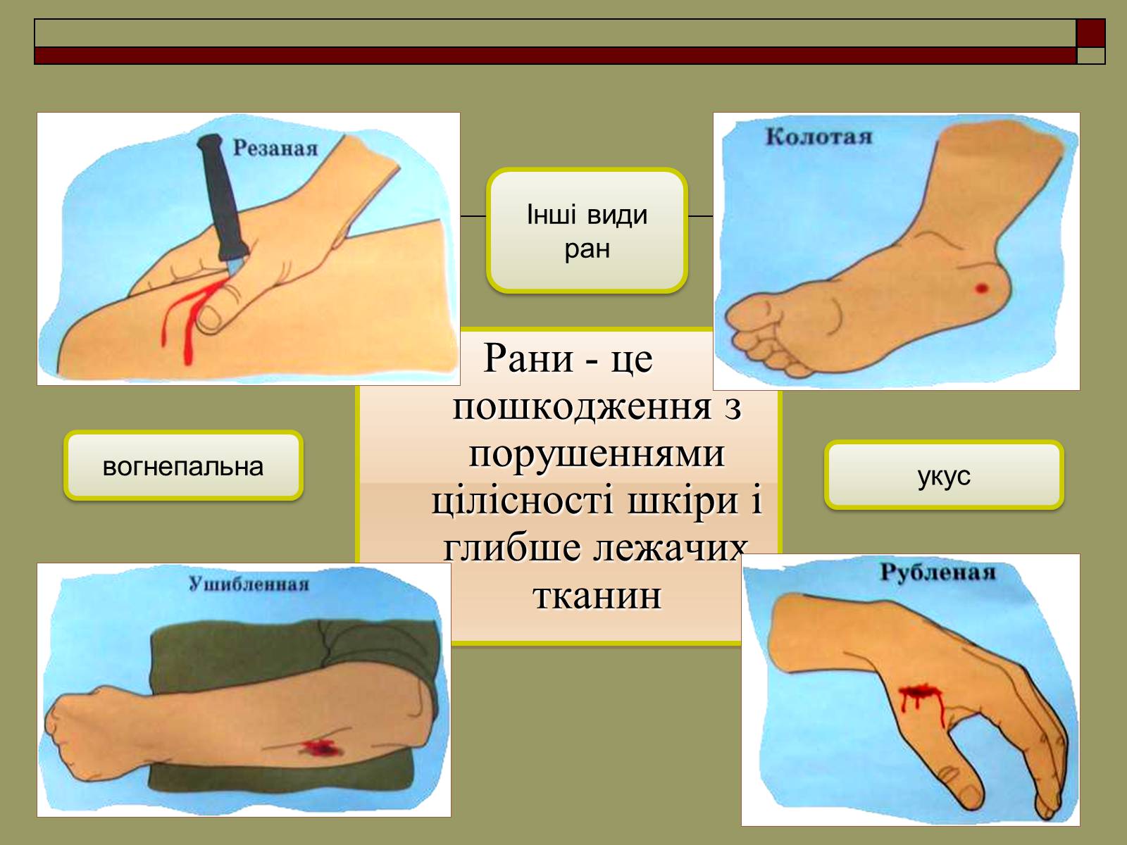 Презентація на тему «Перша медична допомога» (варіант 2) - Слайд #7 Презентація на тему «Перша медична допомога» (варіант 2) - Слайд #7